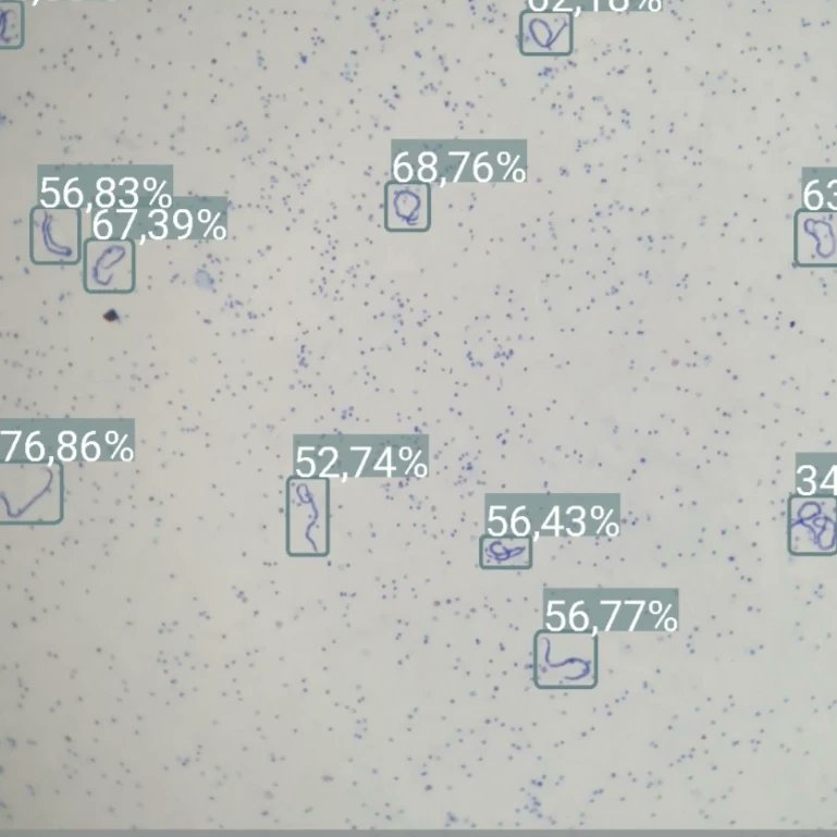 Muy orgullosos de publicar la investigación sobre IA para la cuantificación automática en tiempo real de filariasis en microscopía móvil 👉 journals.plos.org/plosntds/artic…

Un gran trabajo junto con los equipos de la <a href="/La_UPM/">Universidad Politécnica de Madrid</a>, el <a href="/SaludISCIII/">Instituto de Salud Carlos III (ISCIII)</a>, la <a href="/MundoSano/">Mundo Sano</a> y Spotlab 💪🏻
