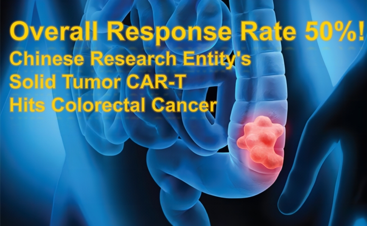 🎯 Overall Response Rate 50%! #ChineseResearch Entity's #SolidTumor CAR-T Hits Colorectal Cancer

More info clic→medtourcn.com/car-t/1758.html

#ColorectalCancer #CARTtherapy #MedicalInnovation  #GCC19CART #CART