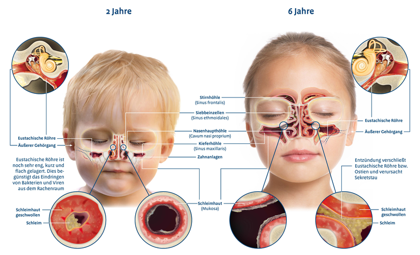 Wenn Eltern mir ganz überzeugt behaupten, ihr 9 Monate altes Kind hätte eine Stirnhöhlenentzündung. Ich: Er hat noch keine Stirnhöhlen und fast keine Kieferhöhlen. Eltern: 😯