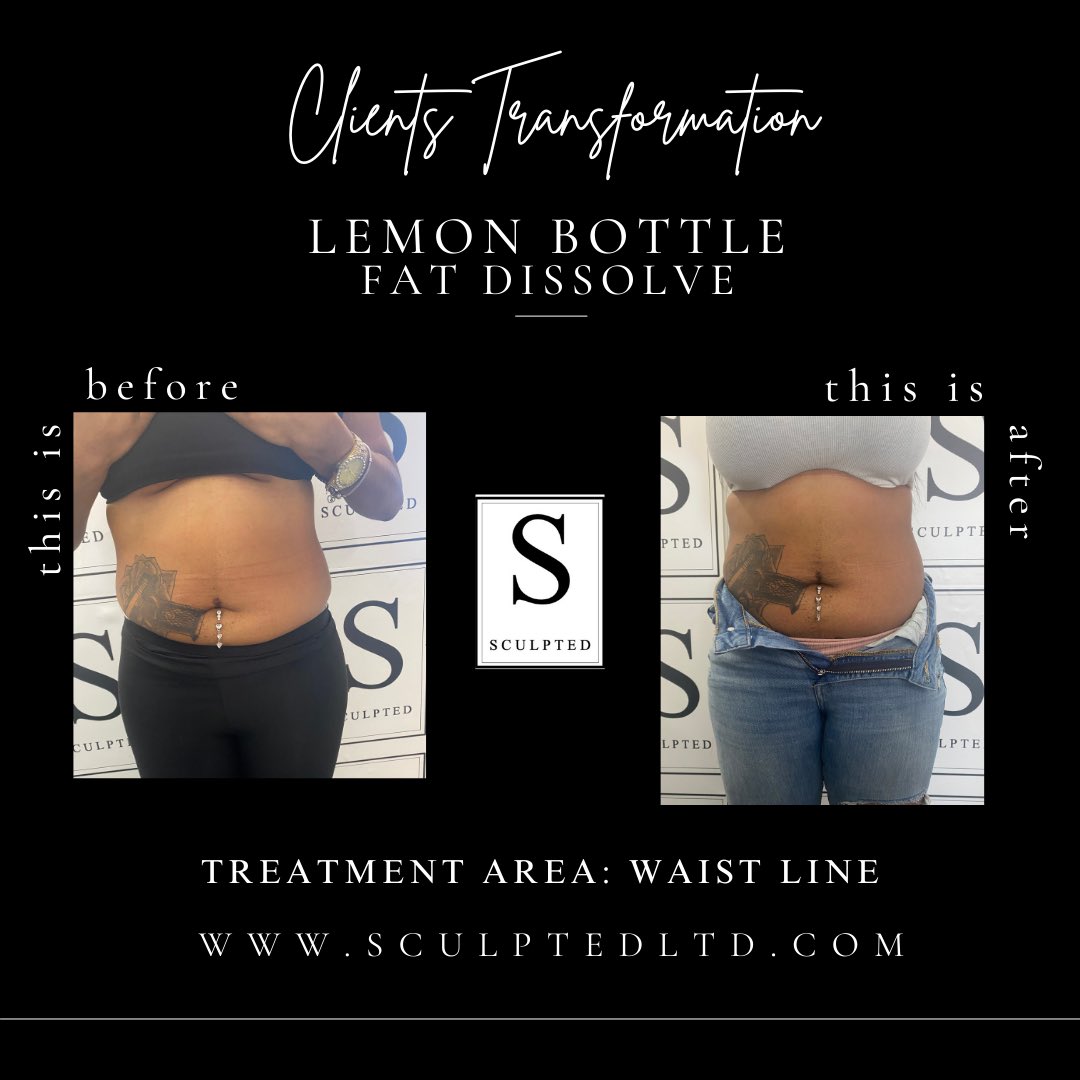 Sculpted_ltd's tweet photo. Lemon bottle treatment 🍋 https://t.co/tfUsI9VQYX
