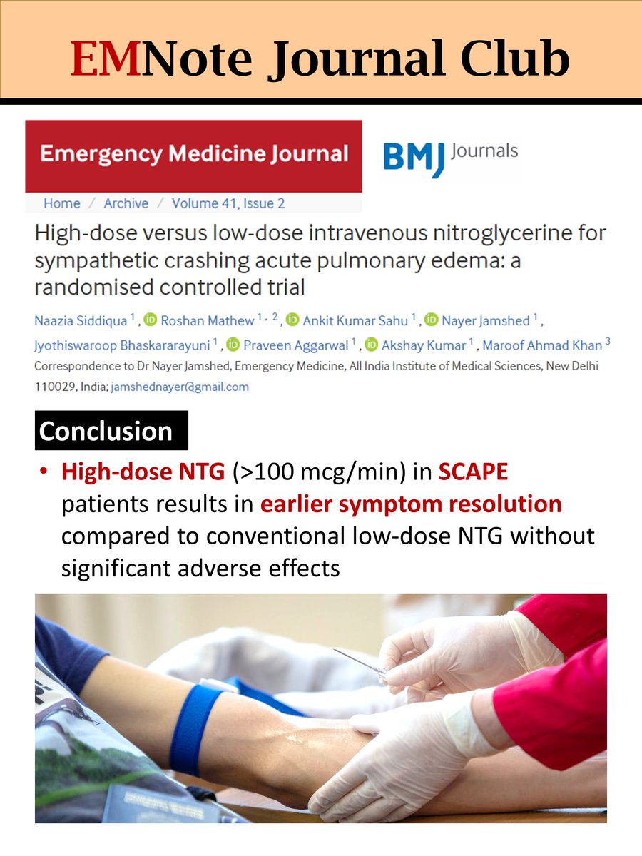 High-Dose NTG for SCAPE. youtube.com/shorts/CbtpPnn… High-dose NTG in SCAPE patients results in earlier symptom resolution compared to conventional low-dose NTG without significant adverse effects.