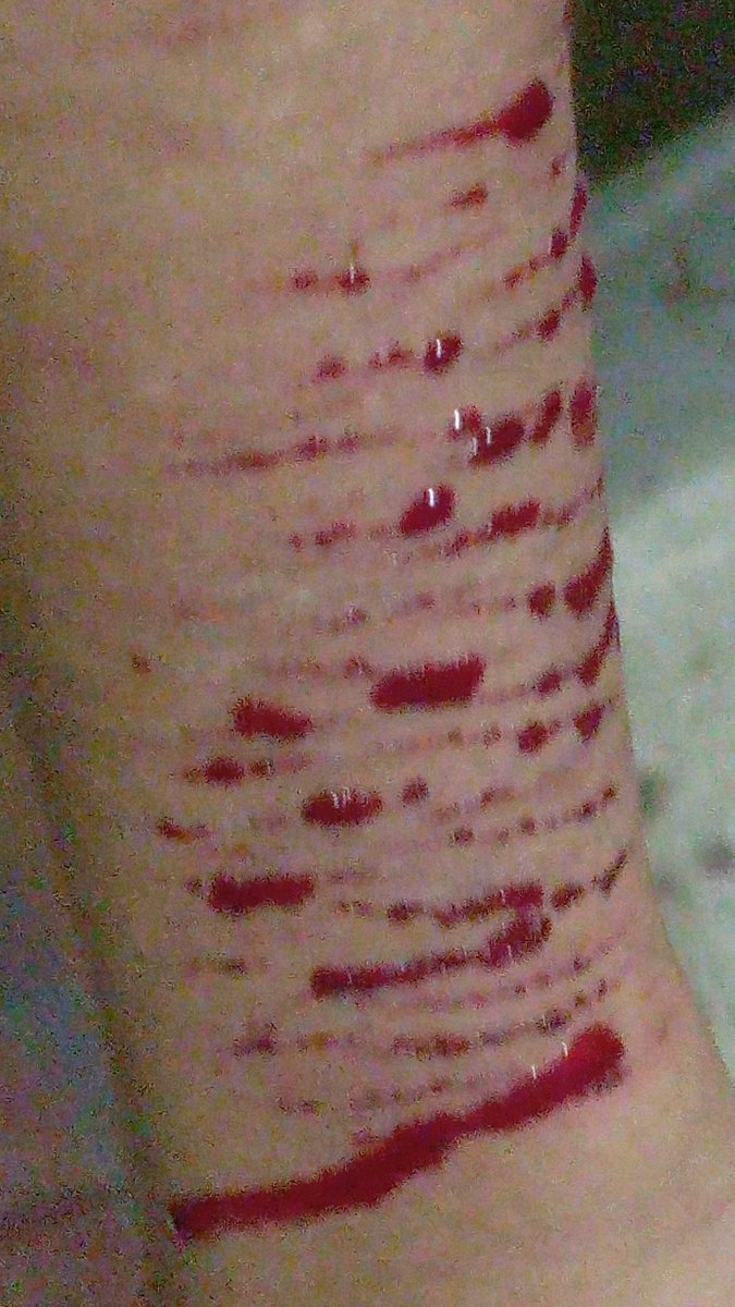 Twsh SH/Self harm, Small cuts & Dry bl00d

I bought only a sharpener hooray