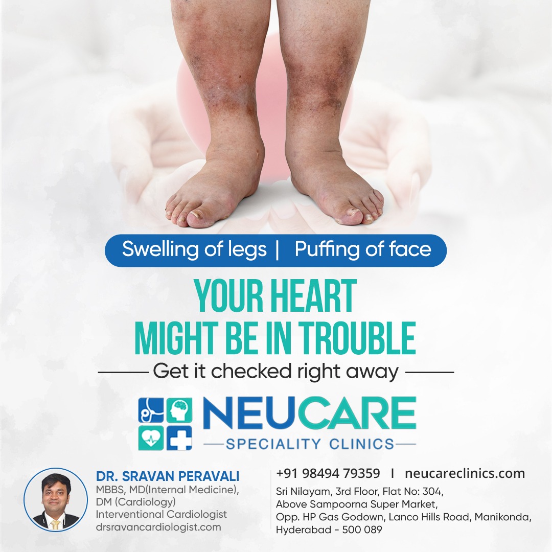 Handling every heart with care!

Walk in for best in class #Cardiac care.

Consult #DrSravanPeravalli for more details!

#Cardiologist #InterventionalCardiologist #Hyderabad
#NeuCareClinics #Manikonda #HitechCity

#Cholesterol #HeartFailure #Stents #HighBP #Blocks and  many more.