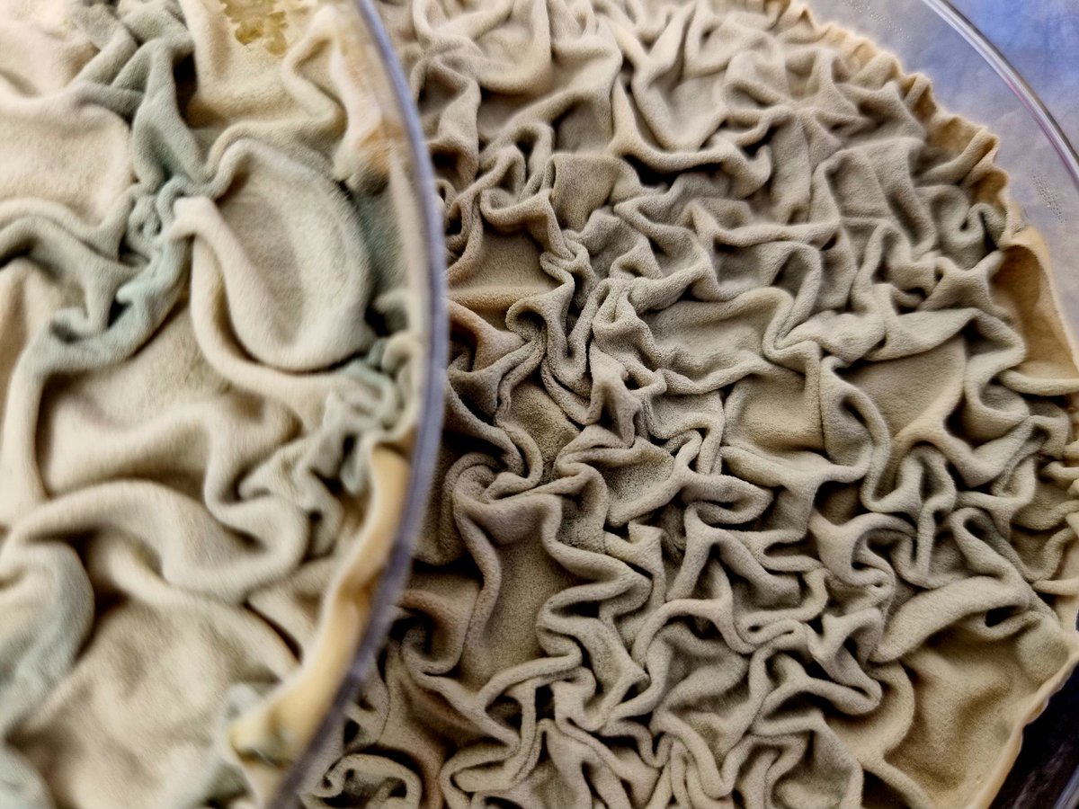 LererVanda's tweet photo. My favorite shape of #Aspergillus fumigatus 🍄
#mycology #fungi #phdlife #academia #Science #mushrooms #mycoviruses #mold #conidia #art #weird https://t.co/d1vJmccqfY