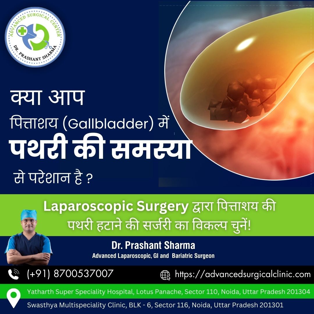 Consult our expert Dr. Prashant Sharma, Advanced Laparoscopic, GI, and Bariatric Surgeon who offers expert care and treatment to his patients.

#DrPrashantSharma #gallstones #Hernia #GISurgeon #BariatricSurgery #HerniaSurgeon #LaparoscopicSurgery #BariatricSurgery #Noida