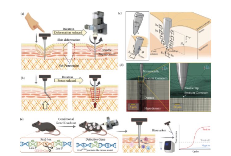 Bioinspired Rotation Microneedles for Accurate Transdermal Positioning and Ultraminimal-Invasive Biomarker Detection with Mechanical Robustness. Click the link below to read this free, open access article. #special_issue #Intelligent_Drug_Delivery_Systems doi.org/10.34133/2022/…