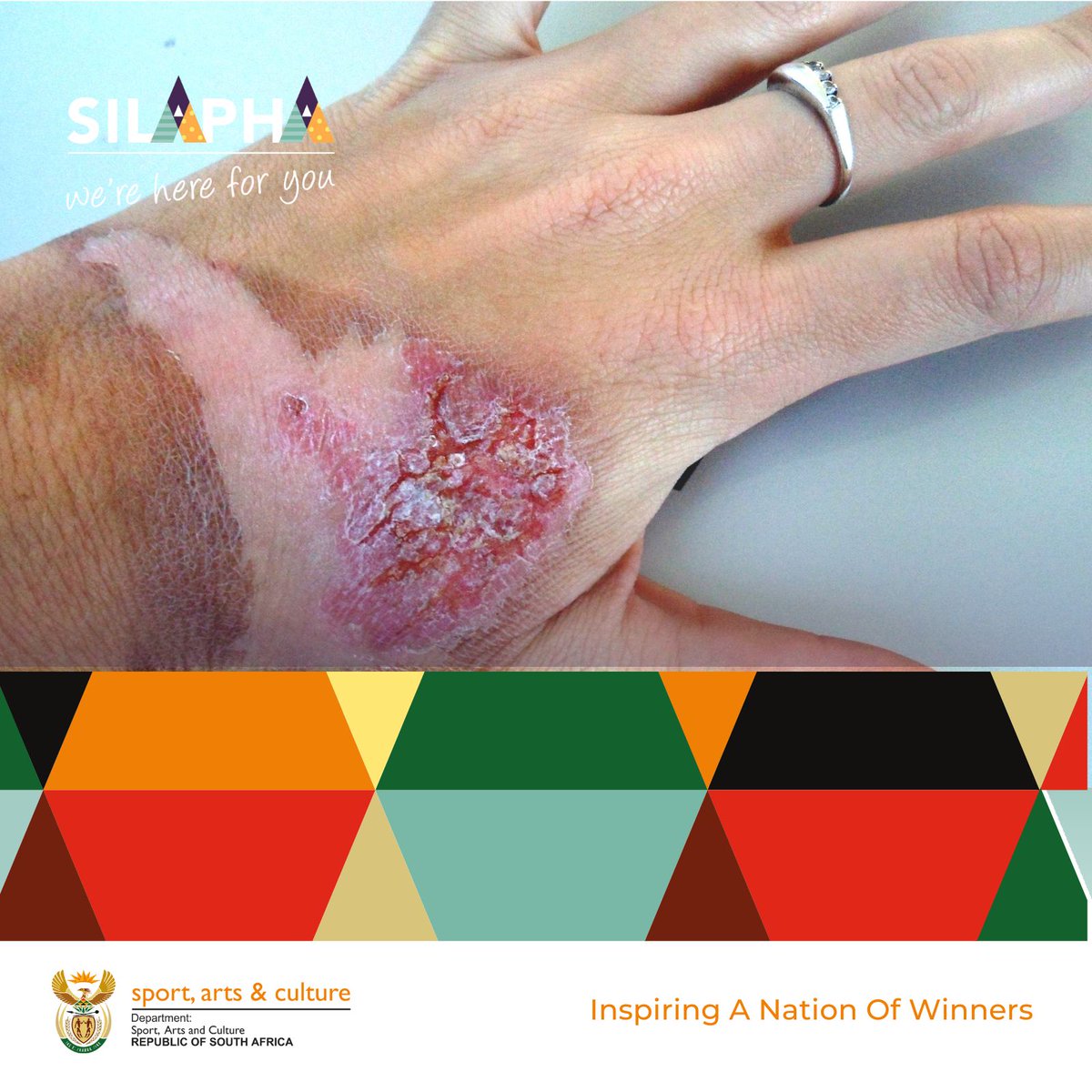 🚑 National Burns Awareness Week is here to remind us of the risks. Artists & athletes, sign up for Silapha and receive support through recovery. You're not alone. dsac.myhealth360.co.za/sign-up/?cid=c… #Silapha #SilaphaWeAreHere4U