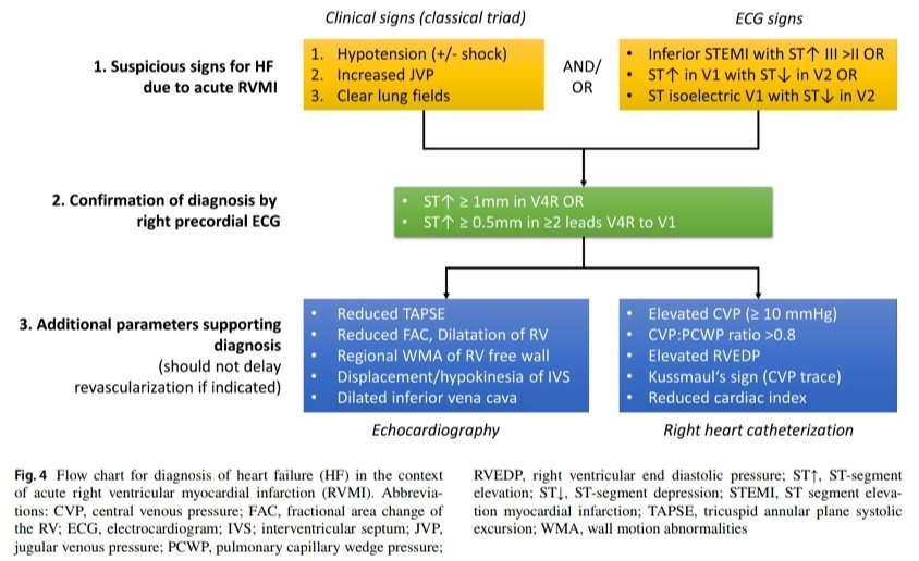 Insuficiencia Cardíaca Posterior al Infarto del Ventrículo Derecho 🫀🧐 🔰📚Current Heart Failure Reports doi.org/10.1007/s11897… Enlace a Artículo Completo 👇🏻✅🆓t.me/SoMELaguna