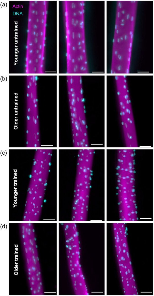 How do endurance exercise and the ageing process affect the positioning and number of myonuclei within muscle fibres? Edmund Battey (@KclPhysiology) et al. investigate in this article! 📜buff.ly/3UuaytN