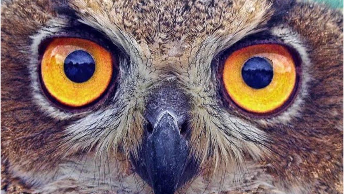 🦉 When you see Owl Eye inclusions in a immunosuppressed patient with diarrhoea

✍️It is hallmark of CMV Infection