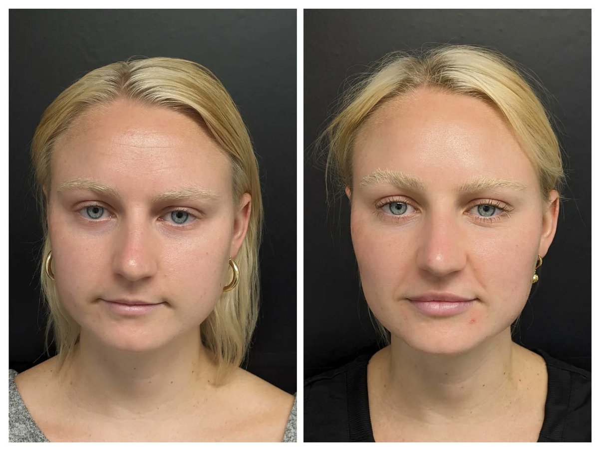 HighPointMedSpa tweet picture
