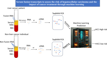 #ArticleinPress: Serum fusion transcripts to assess the risk of hepatocellular carcinoma and the impact of cancer treatment through #machinelearning. Authors from @PLRC_PittLiver and @PittHealthSci. ajp.amjpathol.org/article/S0002-…