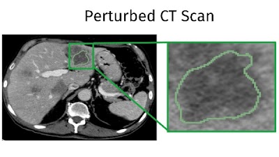 Repeatability and reproducibility analysis identifies precise #radiomics features of CT tumor habitats in lung and liver lesions doi.org/10.1148/ryai.2… @KingaBarcelona @RaqPerezLopez @VHIO #habitats #CancerHabitats #DL