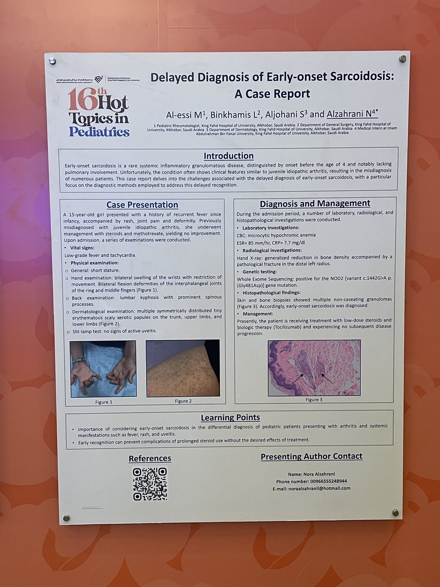 NoraAlzahrani_'s tweet photo. سُعدت اليوم بتكريمي بالمركز الثالث لأفضل Poster Presentation 🥉❤️
وسُعدت جدًا بكوني منظمة في مؤتمر طب الأطفال، كنا فريق على قلب واحد❤️
شكرًا لجميع القائمين على المؤتمر، ممتنة لكل الدعم والتشجيع الذي حصلت عليه من أساتذتي وزملائي.. والحمدلله دائمًا وأبدًا.
#HTP16 #16HTP2024 https://t.co/xtzFn78dZB