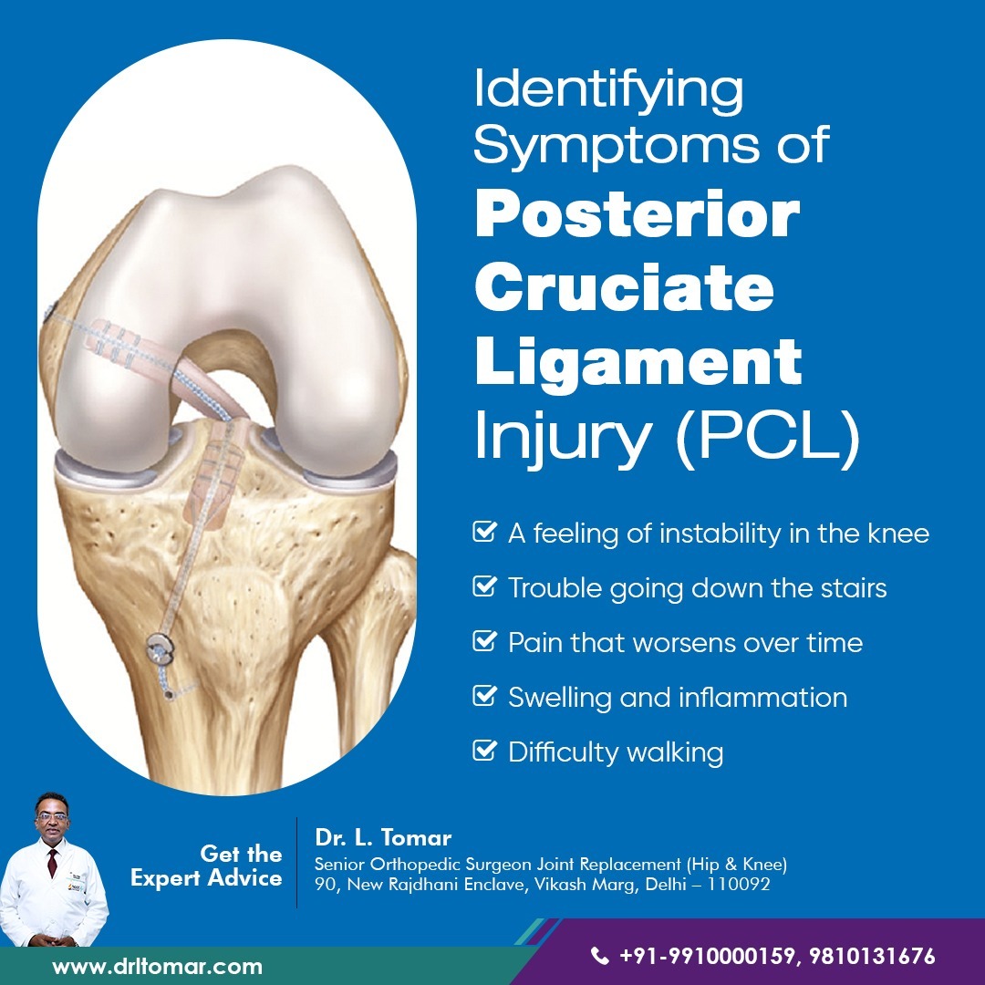 Identifying Symptoms of Posterior Cruciate Ligament Injury (PCL)
- A feeling of instability in the knee
- Trouble going down the stairs
- Difficulty walking

Visit Here for More Info: drltomar.com

#PCL #OrthopedicSurgeon #OrthopedicSurgery #drltomar