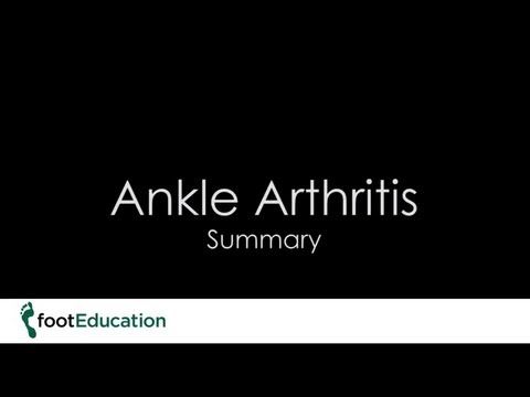footEducation's tweet image. #AnkleArthritis commonly results from a history of trauma to the ankle; either a severe ankle injury, such as a bad ankle fracture, or a series of recurrent injuries to the ankle. Watch: bit.ly/3UhSZx0
Visit bit.ly/3Jmndso