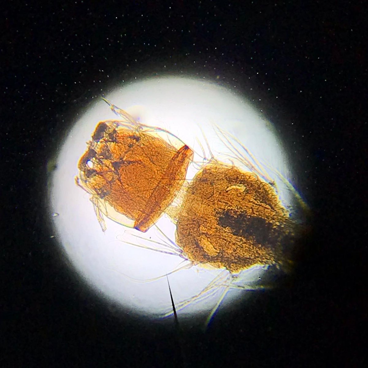 Sıtma etkeni olan Plasmodium'u bulaştıran Anofel larvası (Anopheles mosquito) mikroskobik görüntüsü.
Malarya hakkında bazı bilgiler:
Dünyada ve ülkemizde en sık saptanan sıtma etkeni Plasmodium vivax’dır.
Plasmodium türlerinin son konağı/vektörü Anofel'dir.
#dünyasıtmagünü 🦟