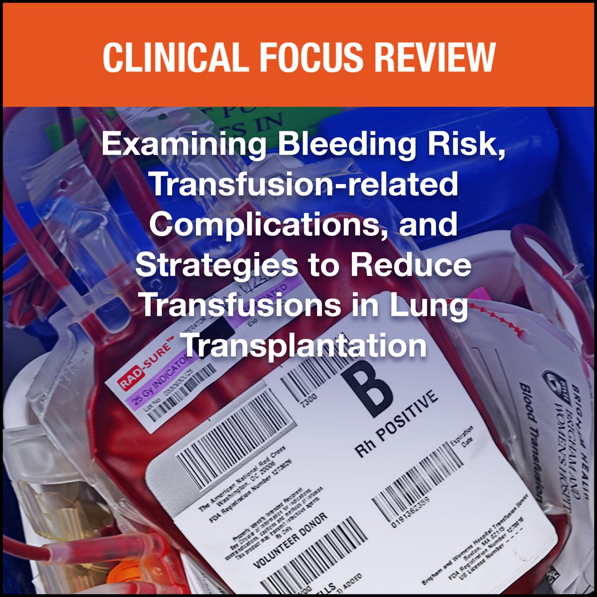 The latest “Clinical Focus Review” published in @_Anesthesiology examines transfusion-related complications as well as patient and procedural risk factors for bleeding and suggests strategies to reduce allogeneic blood product #transfusion. Read here: ow.ly/joKy50Rla9U