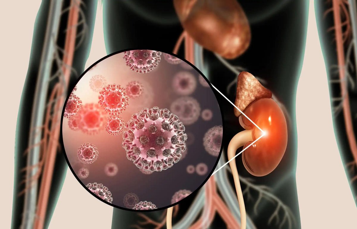 Neoadjuvant PD-1 combination therapy proves effective in improving response rates and survival outcomes for patients with esophageal squamous cell carcinoma. #ClinicalTrials #CancerResearch #esophagealcancer #OncWeekly buff.ly/43X0exH