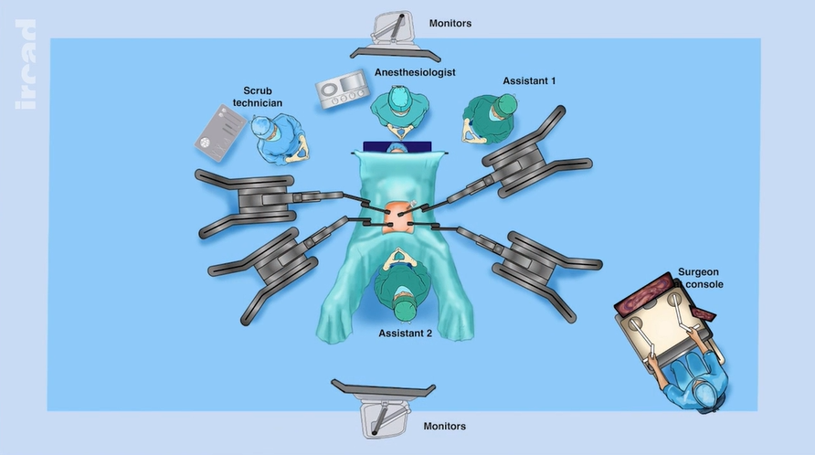 websurg's tweet photo. 🚨#NEW #VIDEO ALERT:
🔗 https://t.co/zPf2SVyb7U
“Robot-assisted radical #hysterectomy and bilateral #salpingectomy with bilateral postero-lateral #parametrectomy and cecum resection for deep #endometriosis with the new Hugo™ RAS system”
#websurg #ircad #surgery https://t.co/TDZitqmiMq