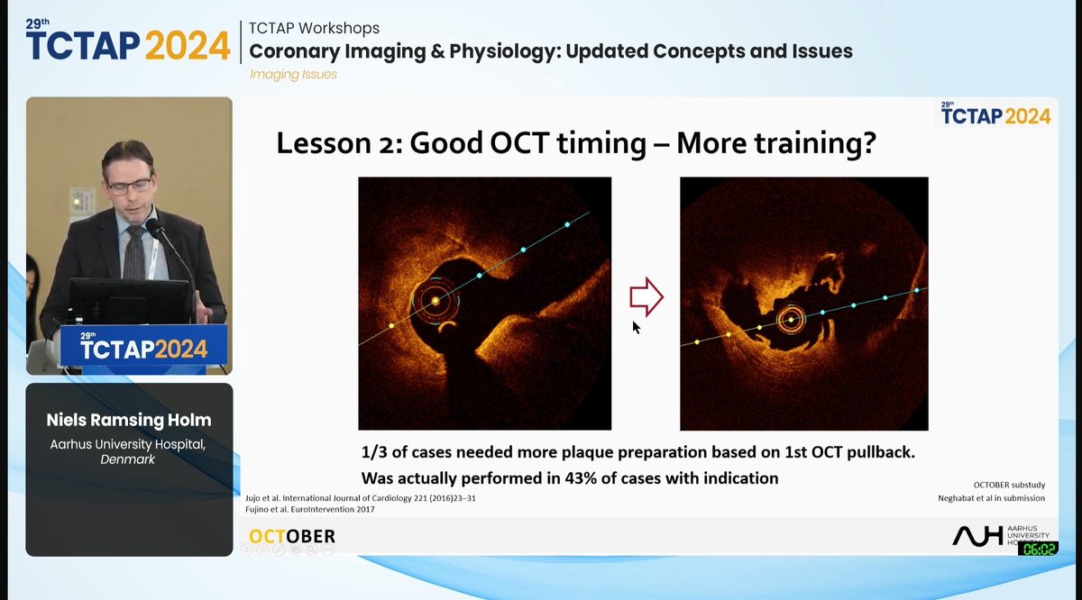 Zill_cardio's tweet photo. #TCTAP2024

#IntravascularImaging

#OCTOBERTrial

💥 OCT-Guided Bifurcation PCI ...

👉 🔟 Lessons learned from using
 O C T,  and "WHAT’s  N E X T" ⁉️

@summitmd_cvrf #BifurcationPCI #ImageFirst #CardioTwitter https://t.co/HGdFdmx8MK