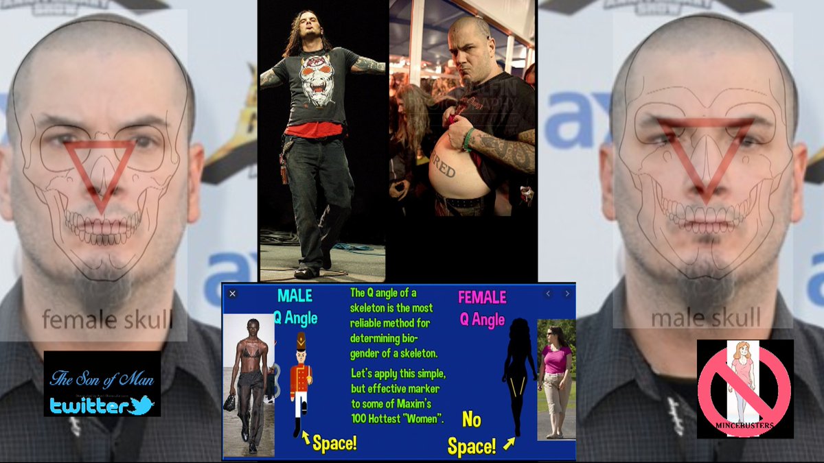 Phil Anselmo fails the Forensic Tests/Bio female Skull match/1x the female gait/legs crossed/1 foot behind the other/1x flamingo foot/but Fanx for playing CSI with me #forensics #CSI #Egi                                                    
    ~ Its ALL of them.. No Exceptions