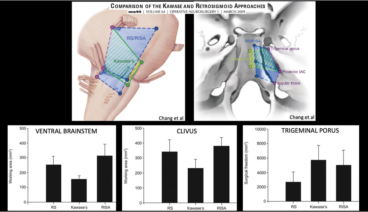#MorcosChallenge Retrosig offers more exposure of ventral brainstem/clivus than Kawase.Adding RISA doesn’t increase exposure of ventral brainstem/clivus.Kawase allows more surgical freedom at porus than retrosig but adding RISA increases surgical freedom&access to mfossa @EvaWuMD