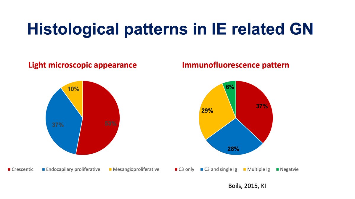 A recap of some of the less recognised histological patterns of GN in IE @ISNeducation @ISNkidneycare  @myadla #ECNeph