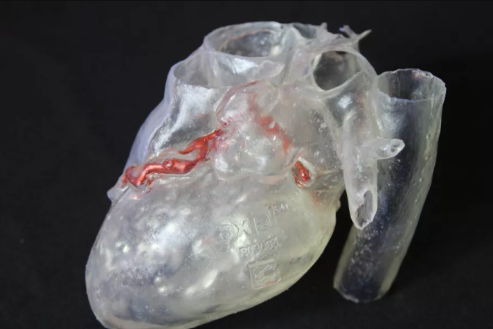 Case of the Week. A 58-year-old patient with #AorticStenosis and a recessive right #CoronaryArtery underwent #AorticValveReplacement, aided by a 3D model. Read more: loom.ly/h17CeY0 #CardiacSurgery Join us at Booth 1312 during #AATS2024 to explore our #3DSolutions.