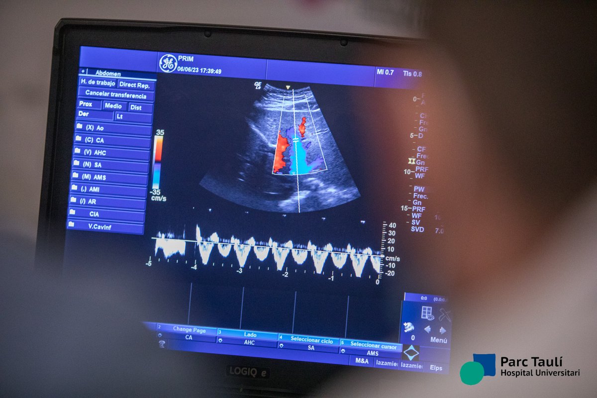 📢#NefroPOCUS <a href="/parctauli/">Consorci Corporació Sanitària Parc Taulí</a> en marcha!
📆3-5 Junio!
✅Cardio
✅Pulmón
✅VExUS
✅Renal
✅Arteria renal/periférica
✅Muscular-nutricional
✅Paratiroides
✅TSA
✅Peritoneal
✅Muscular-nutrición
✅Paratiroides
✅#RealidadVirtual 
🔗tauli.cat/hospital/pocus
🫵Ya sabes!
<a href="/I3ptT/">Institut d'Investigació i Innovació Parc Taulí</a> <a href="/nefroaldia/">nefroaldia</a>