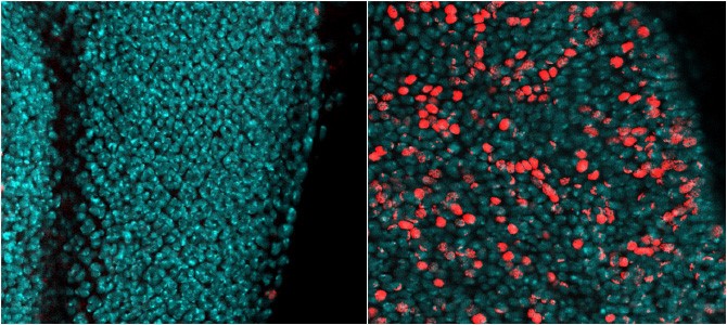 Last @Nature paper from Cavalli's team @IGH_MTP 👁️ rdcu.be/dFD2s 'Transient loss of Polycomb components induces an epigenetic cancer fate' The birth of an epigenetic cancer (left, control tissue, right, epigenetic cancer with proliferating cells labelled in red). 👇