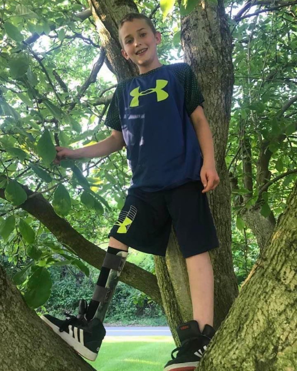 Nemours's tweet image. 🌟 Meet Jaiden! His journey with Fibular Hemimelia embodies courage and the power of a supportive community. Read his inspiring story in honor of Limb Loss &amp;amp; Limb Differences Awareness Month: bit.ly/3w5tdCC #LimbDifferences 🧡🦿