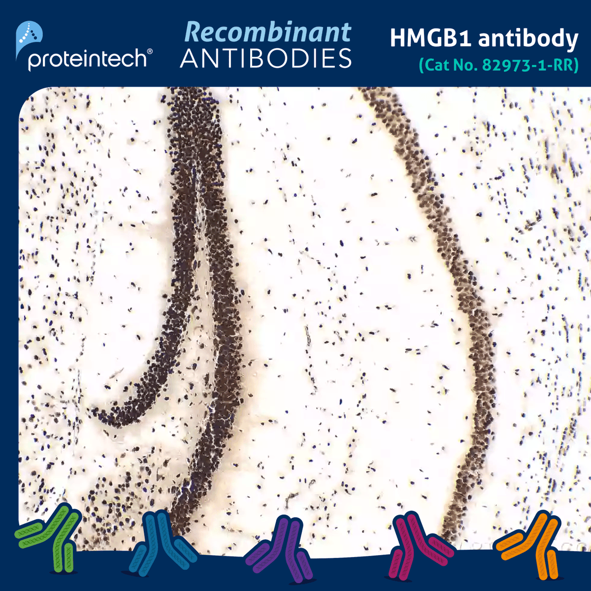 Is HMGB1 playing a role in your disease model? Find out using our new recombinant HMGB1 antibody validated in WB, ELISA, IF, and IHC. All our recombinant antibodies come with high lot-to-lot consistency leading to high data reproducibility. Learn more: ow.ly/3t1850RoaJ1