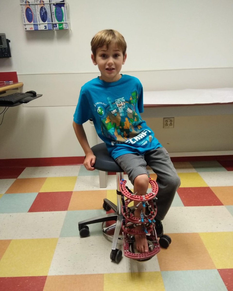 Nemours's tweet image. 🌟 Meet Jaiden! His journey with Fibular Hemimelia embodies courage and the power of a supportive community. Read his inspiring story in honor of Limb Loss &amp;amp; Limb Differences Awareness Month: bit.ly/3w5tdCC #LimbDifferences 🧡🦿