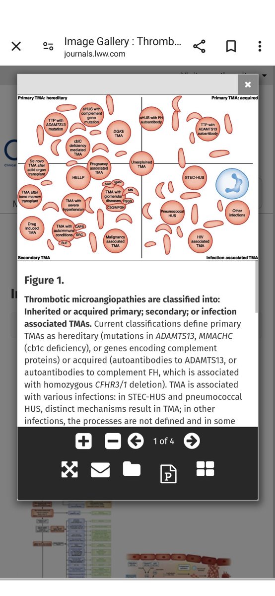TMA is a sign ..the cause might be any of these
Source: @JASN_News 

#ecneph