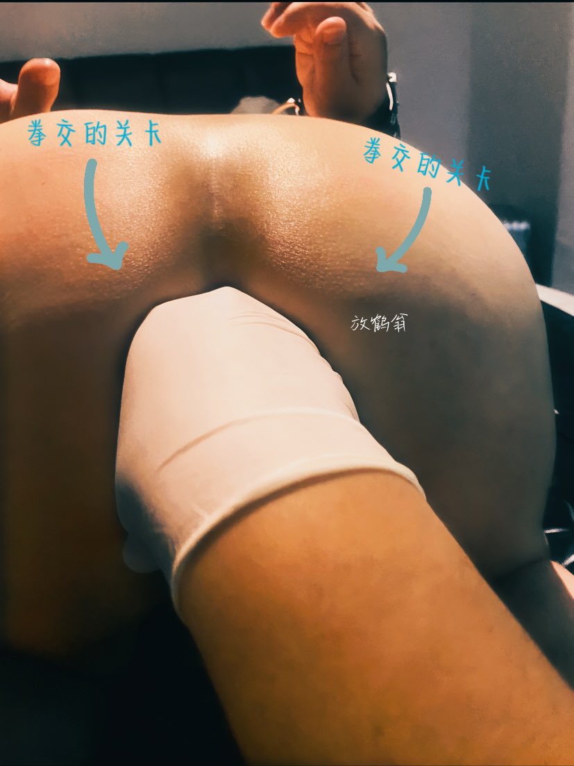 uncleheron1's tweet photo. yeah，2022的总结差不多要做完了😆

这个是我第一个玩的Sg奴，找我的不少，出现的只有他一个…

他的菊花已经是可以拳了的，但是盆骨太小了，或者说我的拳头太大了，卡在骨头那边进不去，看最后一张图😝

以为把手翻过来就可以了，谁知道我还是太低估了我自己的手🤣 https://t.co/hGPyQL4SAH