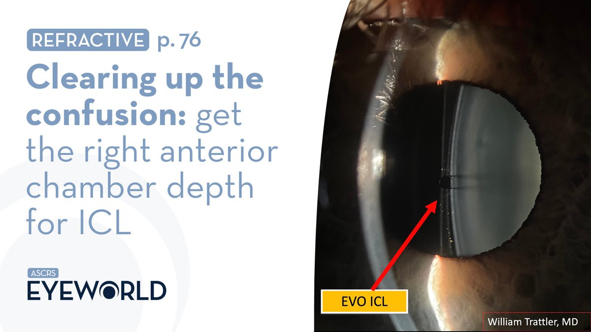 EyeWorld took a deep dive into ACD and EVO in “Clearing up the confusion: get the right anterior chamber depth for ICL” with Scott D. Barnes, MD, Erik Mertens, MD, Audrey Rostov, MD, William Trattler, MD, and Blake Williamson, MD, weighing in bit.ly/3xKYKKx