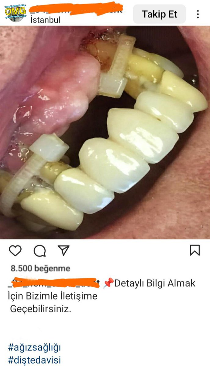 kelepçelerin uç kısımları yuvarlatılmalı. gövde altına kablo kutusu konulursa gövde altları rahatlıkla temizlenebilir, detayını merak etmeyin iletişime de geçmeyin.