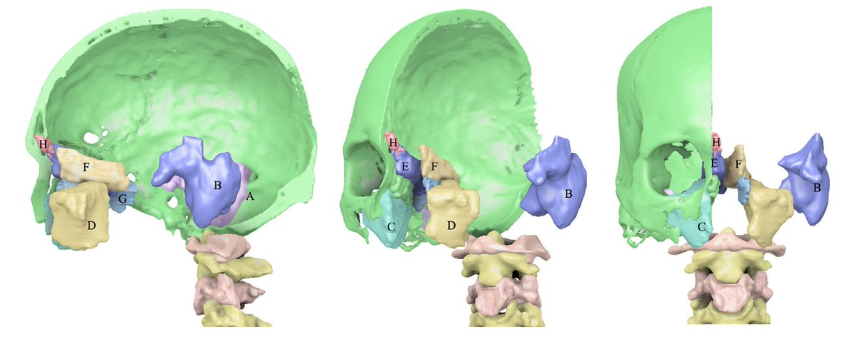 On avance dans la reconstruction de la voix d'Henri IV : après la modélisation de son larynx, c'est maintenant celle de ses sinus qui est achevée : sco.lt/92T8iG