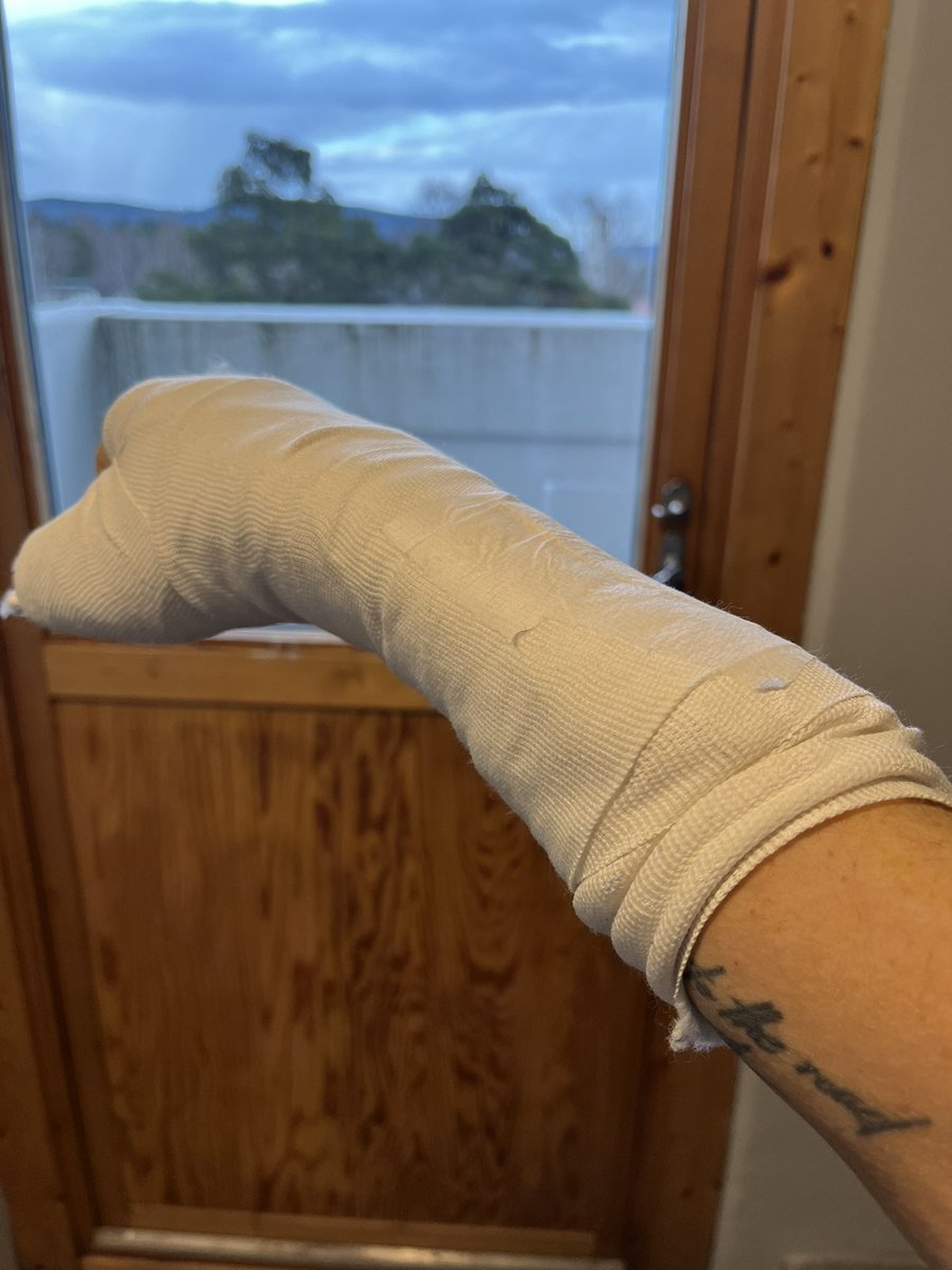 Hei @bringnorge, your male employee who delivered goods at my address tonight, just shouted at me that I was not being fast enough to pick them up, screaming “I don’t have time for you”. This is the condition of my arm. Thanks, very impressed.