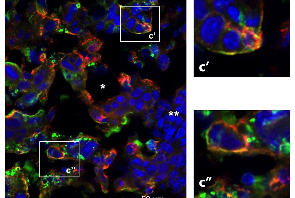 New preclinical study suggests that cytokines, proteins that control immune response, circulating in maternal blood during pregnancy may mitigate offspring's risk for psychiatric conditions, says team led by Dr. Miklos Toth of @WeillCornellGS. bit.ly/44etEr8