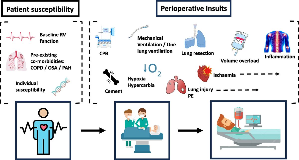 Latest paper from @GJanaesresearch and team in @BioMedCentral #PerioperativeMedicine Looking at the Epidemiology of perioperative RV dysfunction. As highlighted in the article, “there is much to understand, study, and trial in this area.” #rightventricle …tivemedicinejournal.biomedcentral.com/articles/10.11…