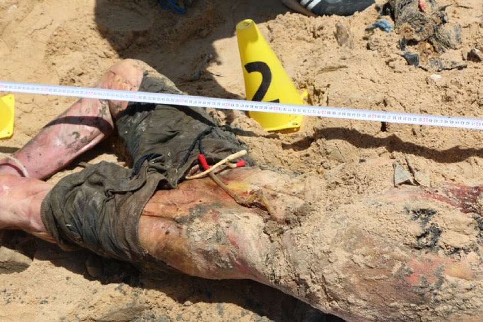 They’re finding the bodies of patients still with tubes in them, buried in mass graves outside the hospital.

The crimes being committed by Israel the US are unprecedented. Anyone who supports this has totally and completely lost their humanity — they have become monsters, too.