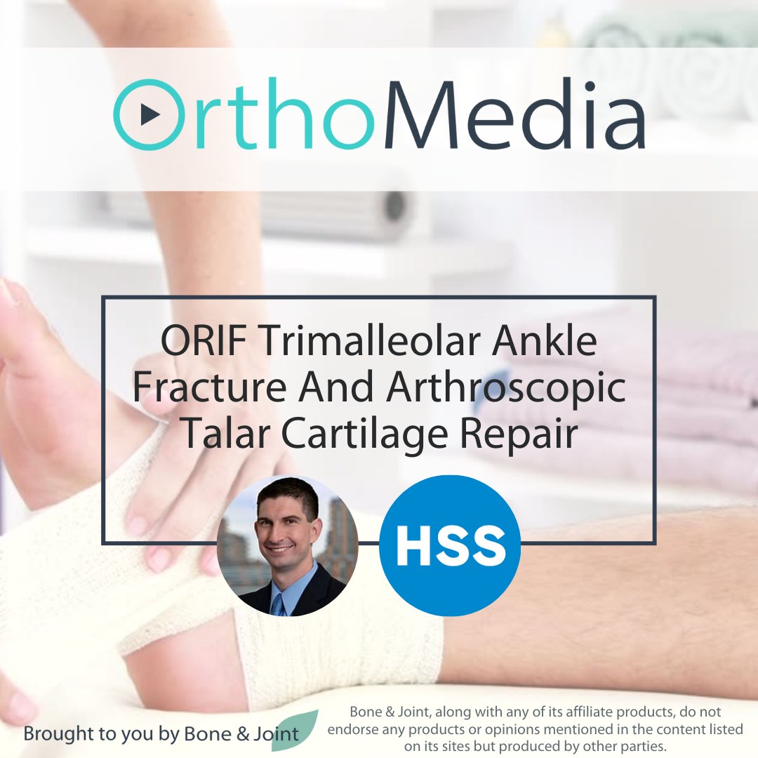 What would your surgical treatment plan be for a 67-year-old male with a bi-malleolar ankle fracture? @MarkDrakos performs a trimalleolar ankle fracture and arthroscopic talar cartilage repair on #OrthoMedia. #Orthopedics #AnkleSurgery @HSpecialSurgery ow.ly/H43b50R3hfe