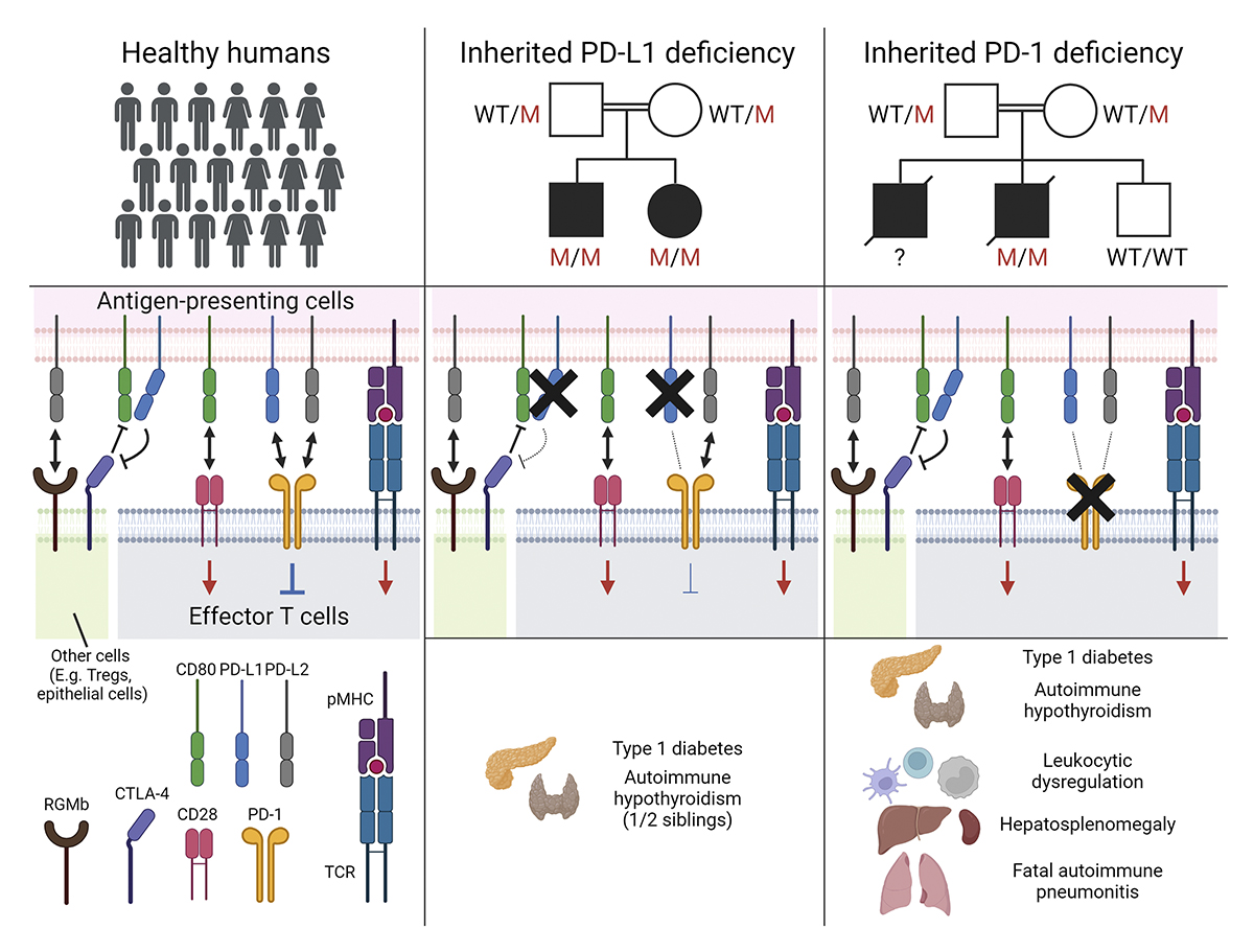 Human inherited PD-L1 deficiency is clinically and immunologically less severe than PD-1 deficiency, say Matthew Johnson (@mbjohnson_), Masato Ogishi (<a href="/MasatoOgishi/">Masato OGISHI</a>), Clara Domingo-Vila (<a href="/ClaraDoVi/">Clara Domingo Vila</a>), <a href="/casanova_lab/">Casanova Lab</a>, TImothy Tree, <a href="/RAOram/">Richard Oram</a> and colleagues: hubs.la/Q02tkwK00