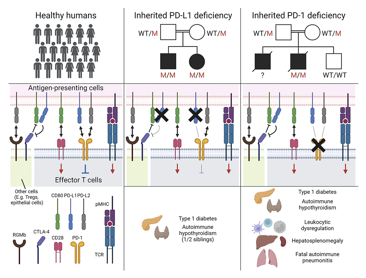 Human inherited PD-L1 deficiency is clinically and immunologically less severe than PD-1 deficiency, say Matthew Johnson (@mbjohnson_), Masato Ogishi (@MasatoOgishi), Clara Domingo-Vila (@ClaraDoVi), @casanova_lab, TImothy Tree, @RAOram and colleagues: hubs.la/Q02tkwK00
