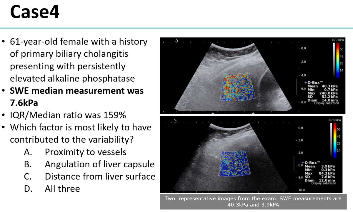 Thank you to @arincozturk from @MGHImaging for giving us a guest lecture on shear wave #elastography to diagnose chronic liver diseases! #RadEd #RadTwitter #RadX