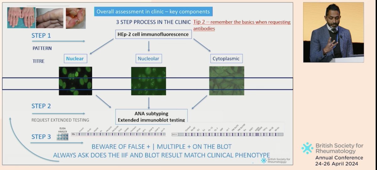 🔥12 Golden Tips to remember from a fantastic session on #Myositis in #BSR24 #RheumX 🌟Must see for every clinician!!🌟 ✅ Defining the syndrome ✅ Ordering the appropriate tests ✅ Correct interpretation ✅ When to Biopsy ✅ Treatment conundrums ✅ Identify the mimickers 1/4