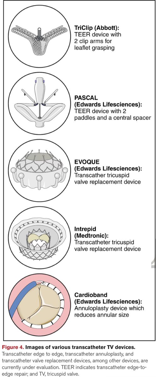 📌The Tricuspid Valve: A #Review of Pathology, Imaging, & Current Treatment Options: A 📝 From the @American_Heart #VHD #EchoFirst