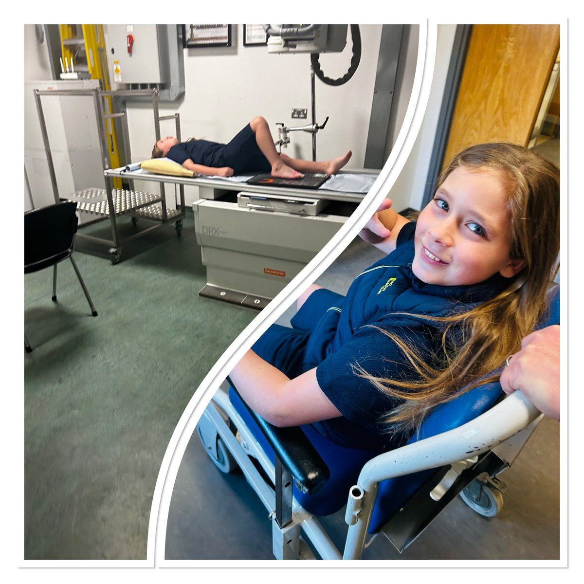 Early morning visit to #ysbytyystradfawr foot squished by Lucy the horse🐴 🧲 makes a change from gymnastic injuries - nothing broken thank goodness 😅efficient service at a very busy minor injuries unit, TY @AneurinBevanUHB we are so fortunate to have our NHS 🫶🏻💙